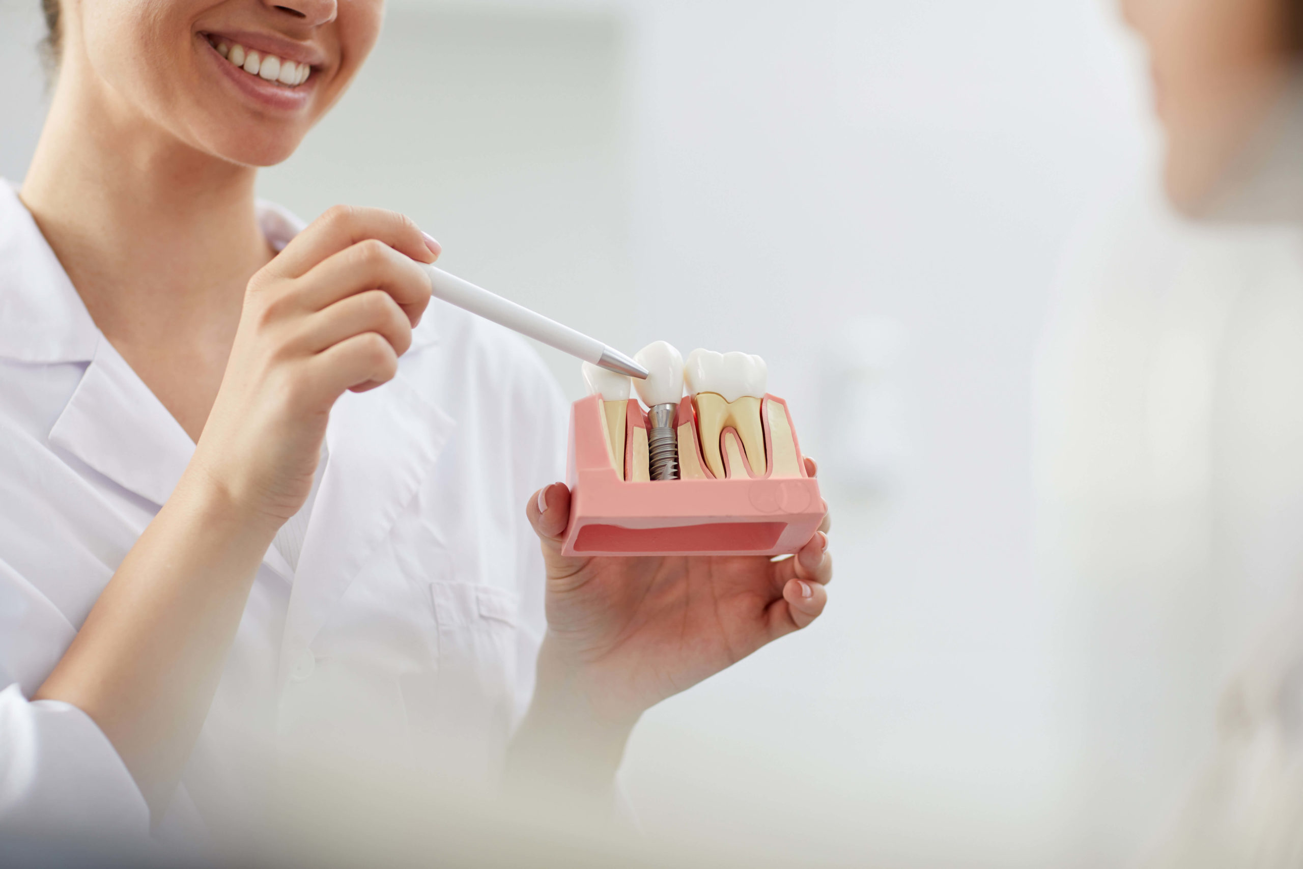 Affordable Dental Implants: Costs, Options, and Financing
